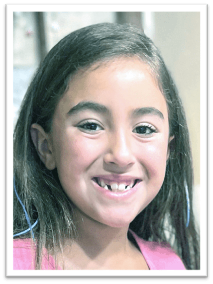 Smiling young girl missing front teeth.